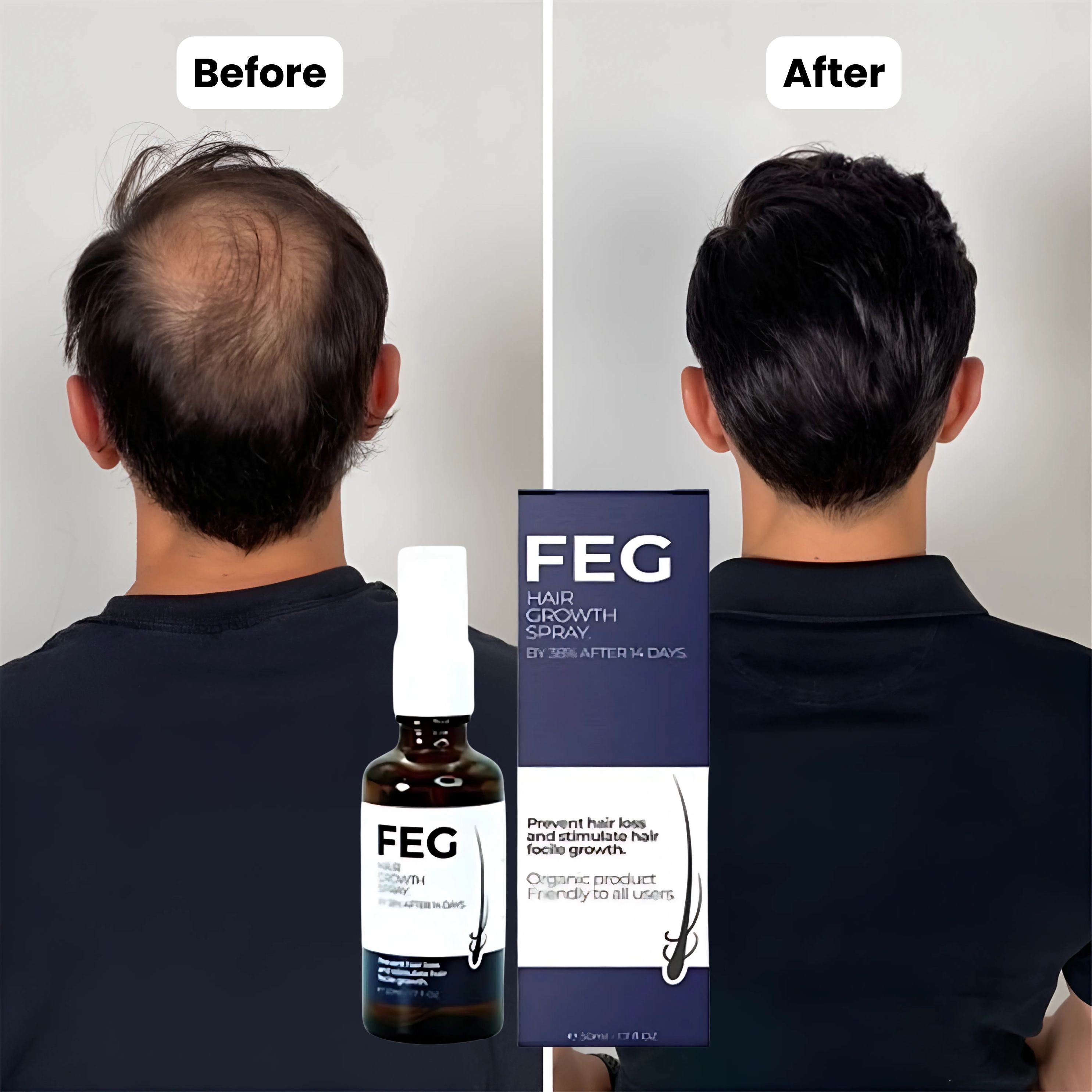 FEG PLUS Hair Growth Spray 50ml